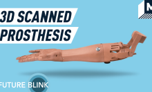 This might be the most customizable and affordable prosthetic arm yet — Future Blink