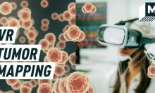 split screen: on the left, 3D cancer cells flood the screen as a woman wears a VR set in the left image; caption reads: VR tumor mapping