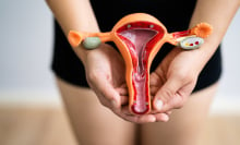 white person holding model of the uterus
