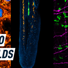 A split screen shows three colourful images of cell processes. Caption reads: "micro worlds"