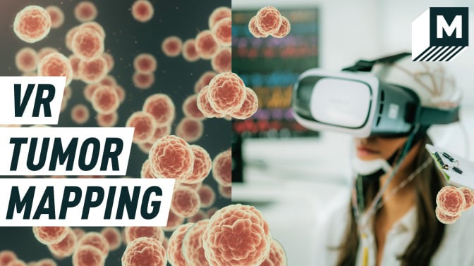 split screen: on the left, 3D cancer cells flood the screen as a woman wears a VR set in the left image; caption reads: VR tumor mapping